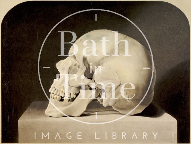 Side view of ancient skull from a stone coffin found in Bath in 1852